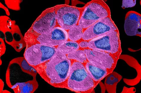 Photo de microscopie 