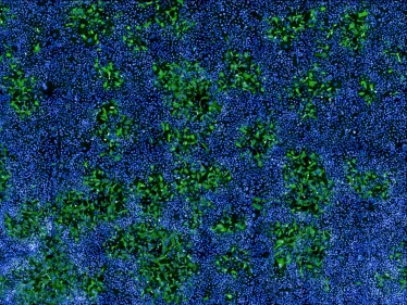 Cellules humaines infectées par MPXV © Institut Pasteur/Mathieu Hubert et Olivier Schwartz