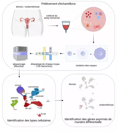Recherche de biomarqueurs de l’endométriose à des fins diagnostiques, à partir d'échantillons de sang menstruel