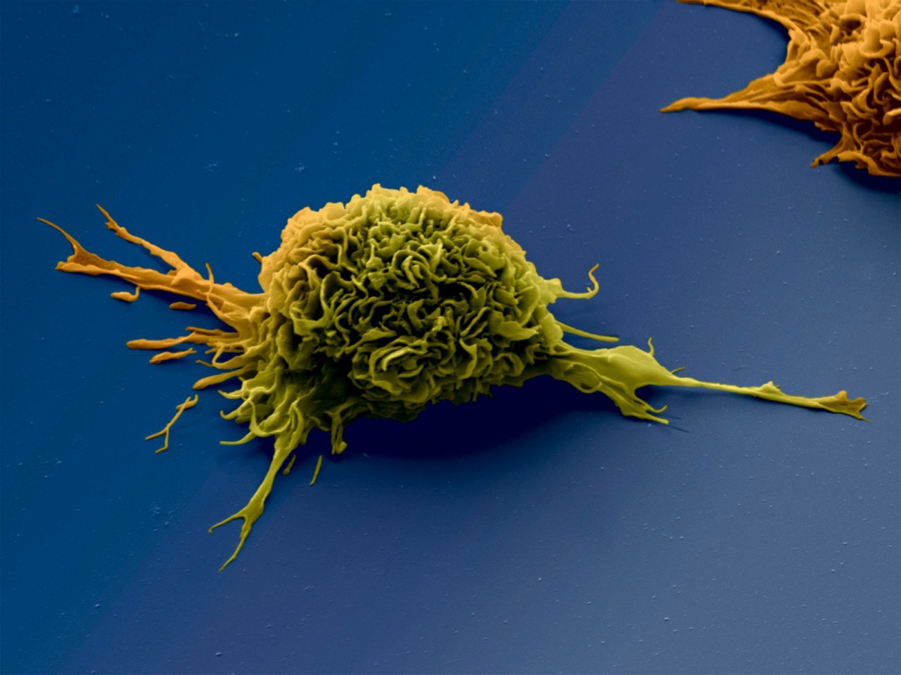 Cellule dendritique vue en microscopie électronique à balayage. Les cellules dendritiques sont des cellules importantes de l'immunité.