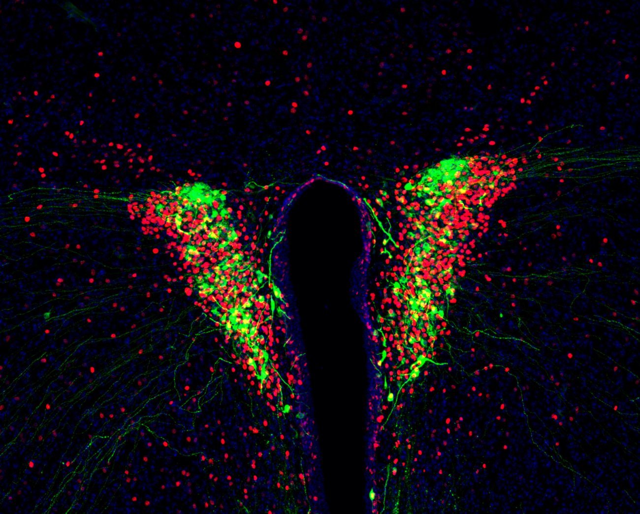 Neurones produisant des hormones dans l'hypothalamus. Dans l’hypothalamus, les neurones produisant la vasopressine (vert), une hormone indispensable pour la réponse de stress et antidiurétique, sont activés par une inflammation du sang (c-Fos, rouge).