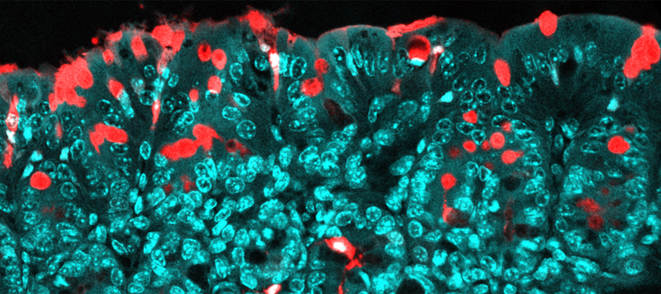 Passage de molécules au travers de l’épithélium du colon, via des voies spécialisées (les cellules de goblet). En rouge : les molécules transportées (antigènes) ; en bleu : l’épithélium. Passage de molécules au travers de l’épithélium du colon, via des voies spécialisées (les cellules de goblet). En rouge : les molécules transportées (antigènes) ; en bleu : l’épithélium.