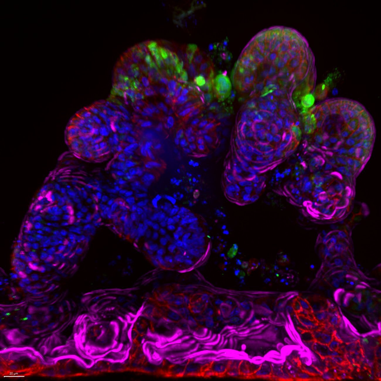 Coupe transversale d'un Ileum-organoid-on-chip humain infecté par le SARS-CoV-2 pendant 48 heures.