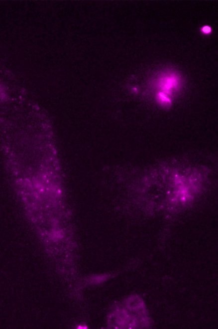 Expression de CCR5 corécepteur cellulaire du VIH sur la surface de macrophages 