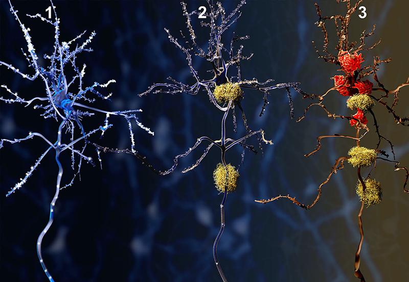 Mieux comprendre et combattre les maladies de la connectivité cérébrale et les maladies neurodégénératives - Institut Pasteur