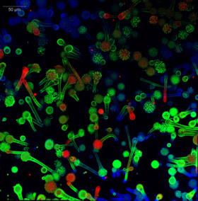 aspergillus_fumigatus.jpg