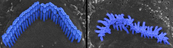 Touffes ciliaires de cellules ciliées externes © Institut Pasteur