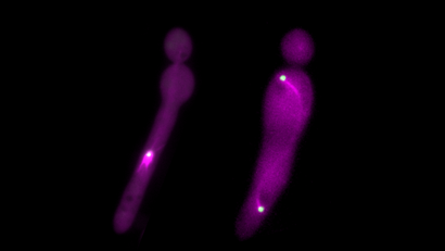 Cellules modifiées de C. albicans - Institut Pasteur