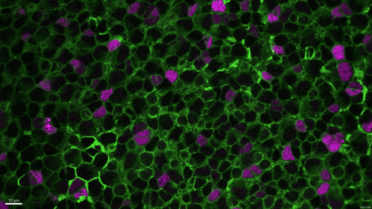Cellules souches neurales © Institut Pasteur/Nicolas Dray, Laure Mancini, Laure Bally-Cuif