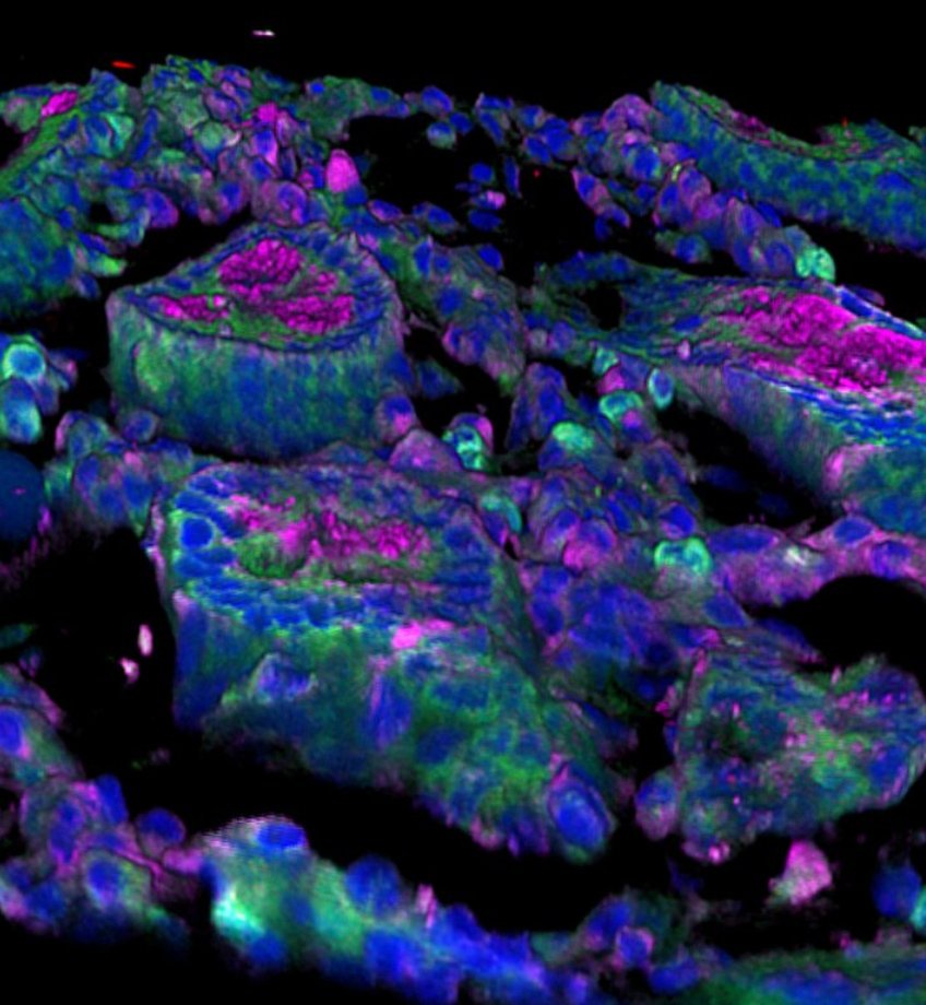 Cellules intestinales produisant une cytokine, qui protège contre le SIDA le singe vert africain infecté par le SIV. Crédit :Institut Pasteur/Nicolas Huot