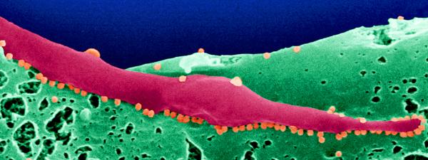 virus du Chikungunya (en orange) bourgeonnant à la surface de cellules infectées de moustique Ae. albopictus. © Institut Pasteur