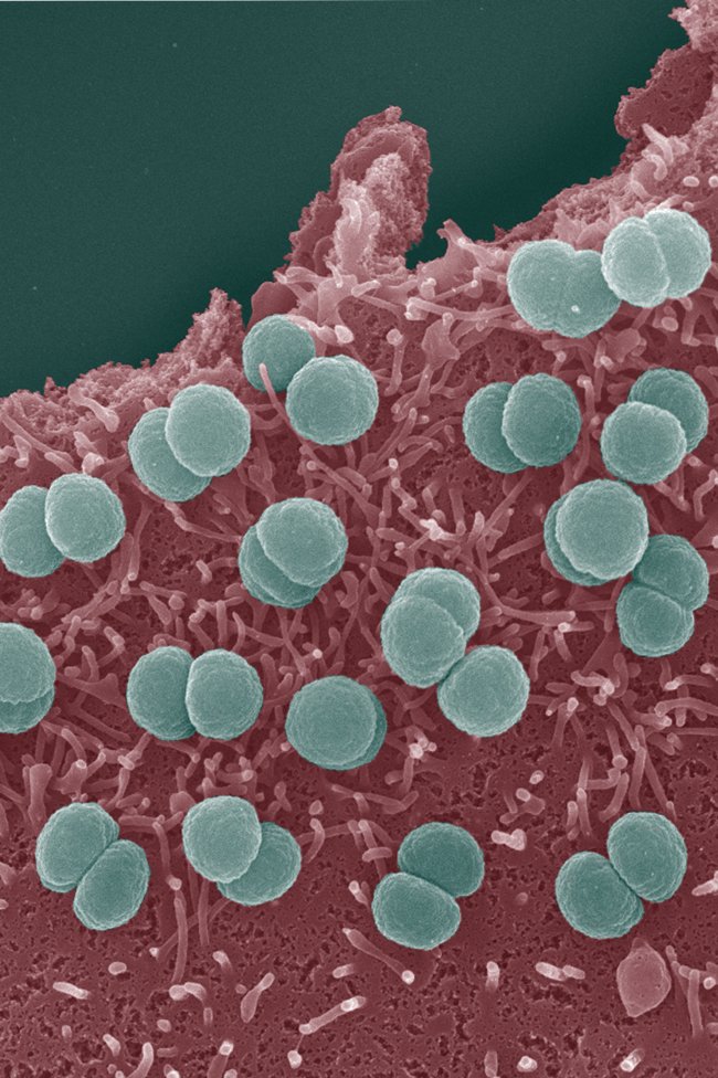 cours épidémiologie vaccinale 