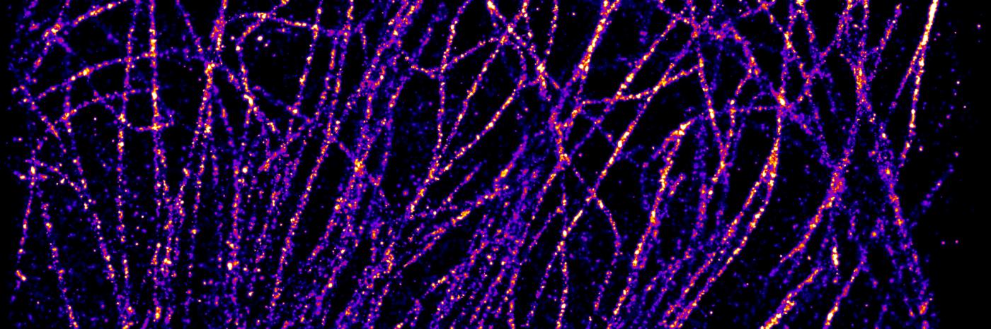 Fluorescence Microscopy Workshop, Institut Pasteur Fluorescence Microscopy Workshop, Institut Pasteur