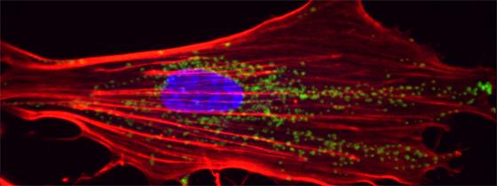  Fibroblaste provenant de la peau d’un patient atteint du syndrome de Cockayne. © Institut Pasteur