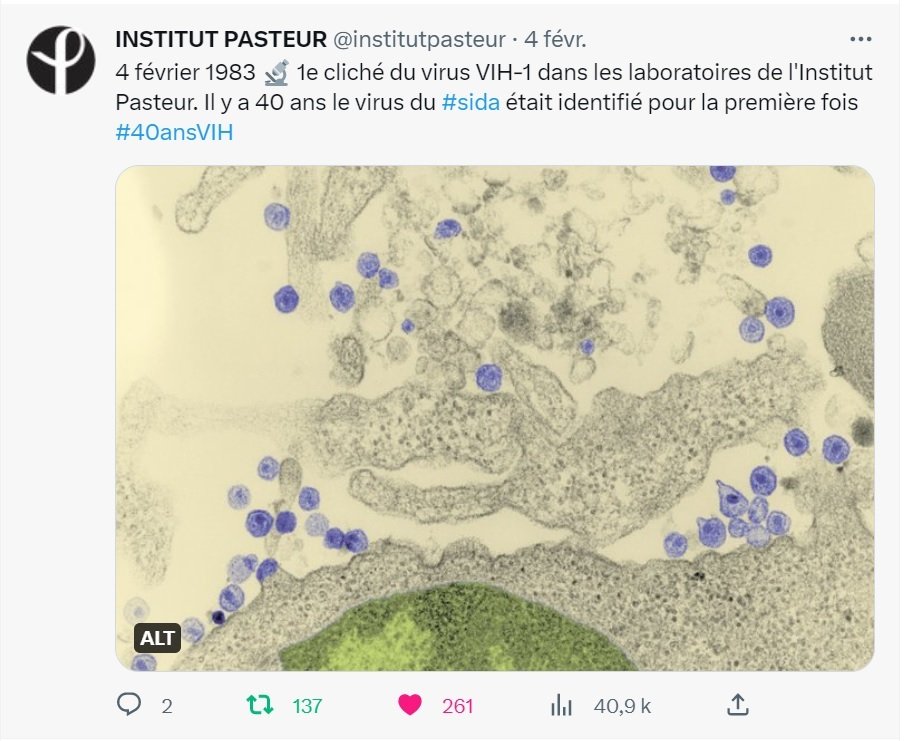 Sida- VIH - Institut Pasteur