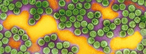 Papillomavirus maladie infectieuse Virus del papilloma umano verruche - Parazitii din corpul uman