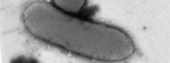 Photo en microscopie électronique à transmission en coloration négative. © Institut Pasteur