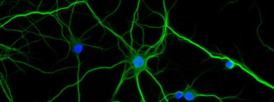 Neurones. © Institut Pasteur/Philippe Casanova