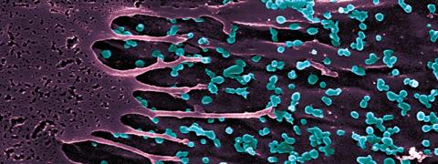 Virus Chikungunya à la surface d'une cellule © Institut Pasteur/Thérèse Couderc
