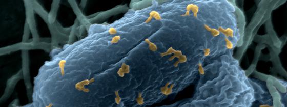  Bacteriophages on bacteria. © Institut Pasteur