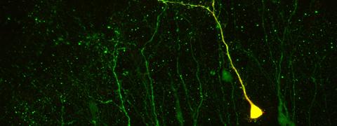 Néo-neurones dans un cerveau adulte, Pierre-Marie Lledo, © Institut Pasteur