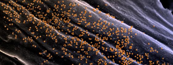 Particules du virus Chikungunya à la surface d'un fibroblaste. © Institut Pasteur