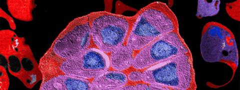 Globule rouge parasité par Plasmodium falciparum, © Institut Pasteur/Biologie des Interactions Hôte-Parasite