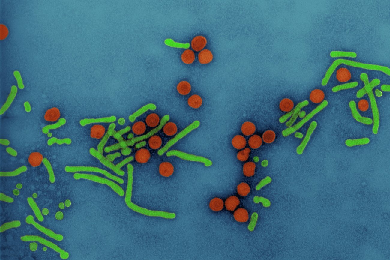 virus de l'hépatite B (VHB)