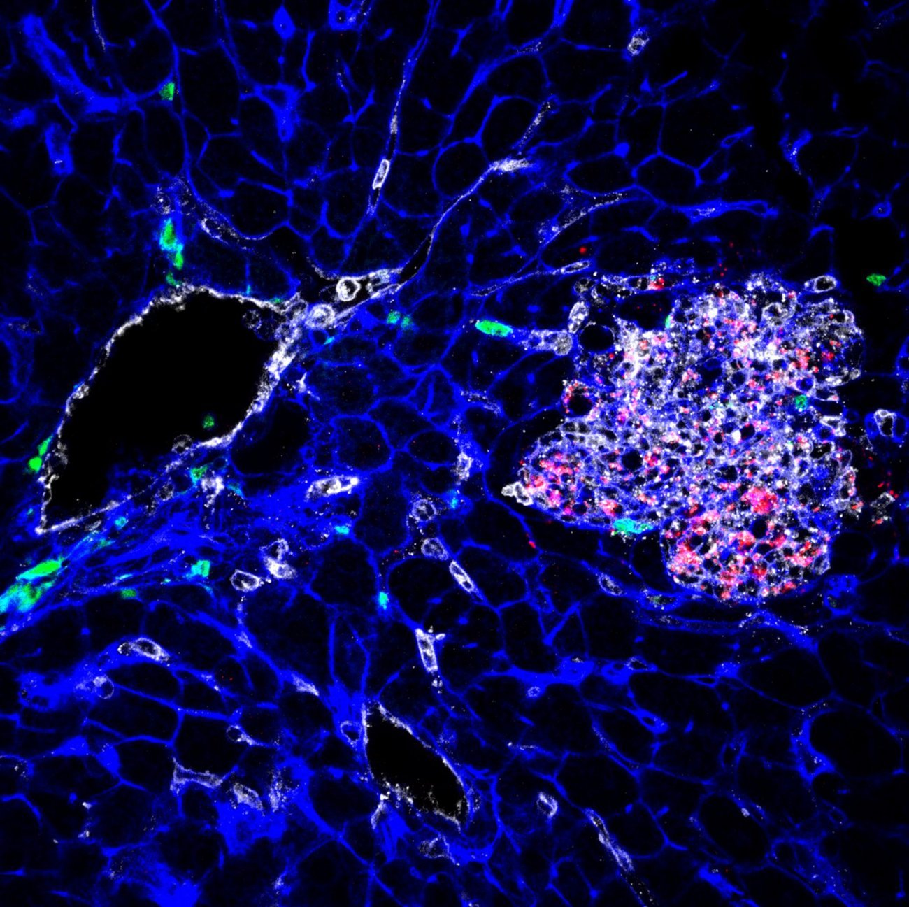 Placenta infecté par Listeria monocytogenes (la bactérie apparaît en rouge) © Institut Pasteur 