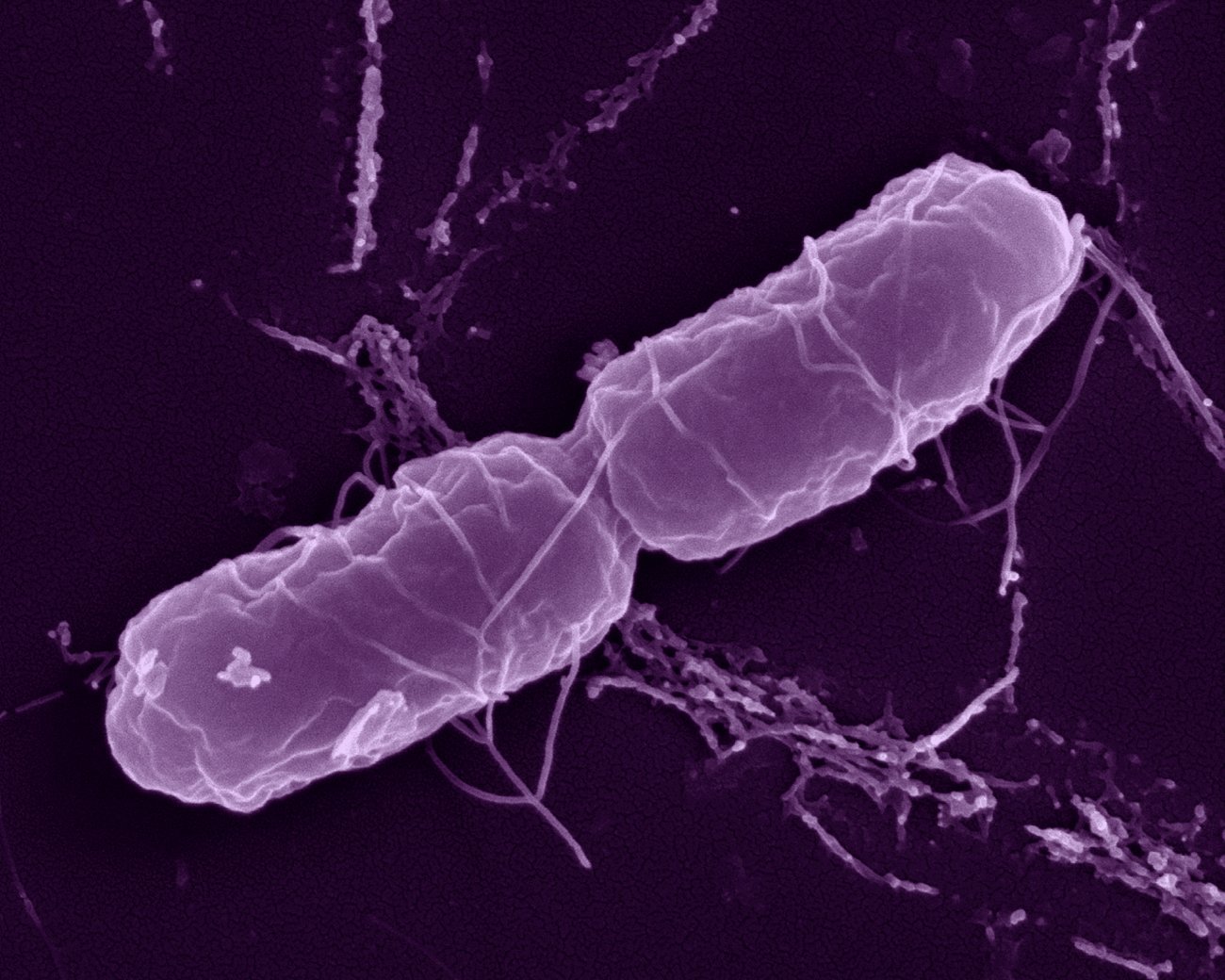 Bactérie Salmonella enterica en microscopie à balayage. © Institut Pasteur