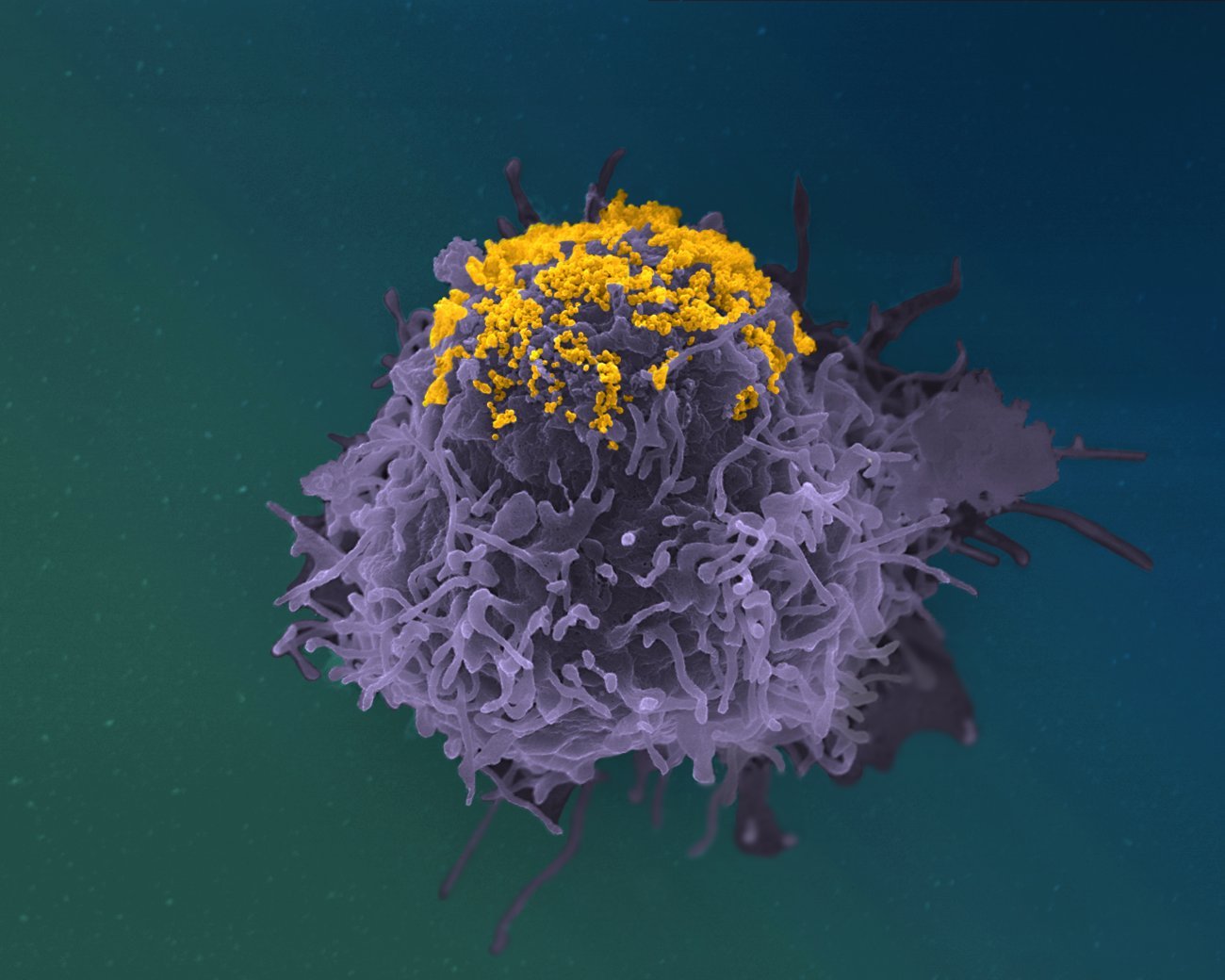 Accumulation de particules de VIH à la surface d’une cellule infectée - Institut Pasteur