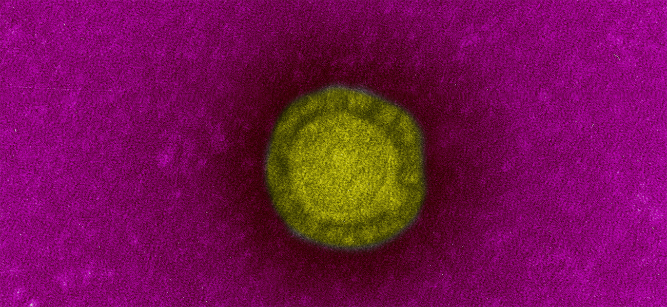 Fiche Maladie - Coronavirus de Wuhan - Institut Pasteur