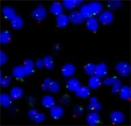 lymphocytes-foetuscp.jpg