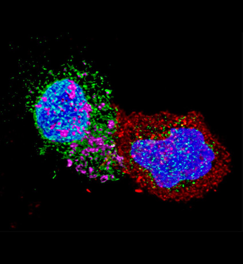 Cellules CD8 de patients contrôleurs en contact avec des cellules CD4 infectées par le VIH 