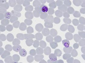 plasmodium_sd.jpg