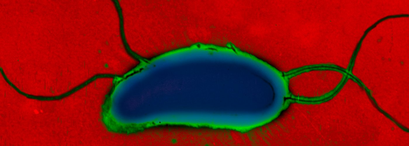 Fiches maladies - Choléra - Institut Pasteur