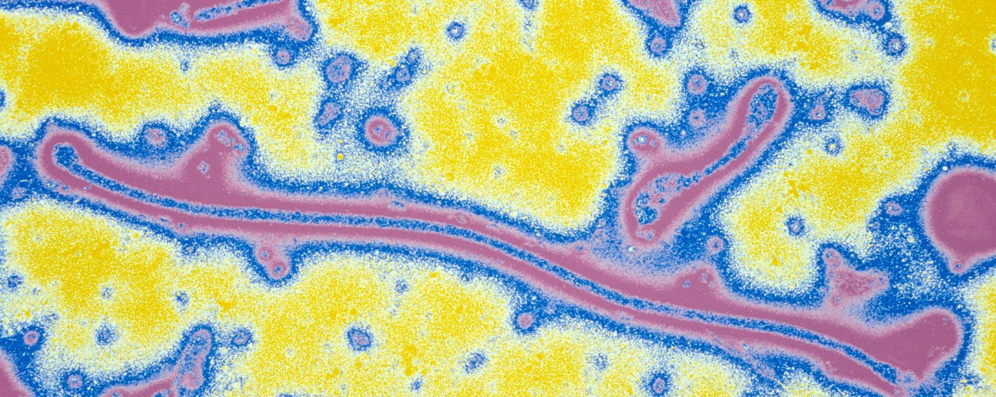 Fiches maladies - Ebola - Institut Pasteur