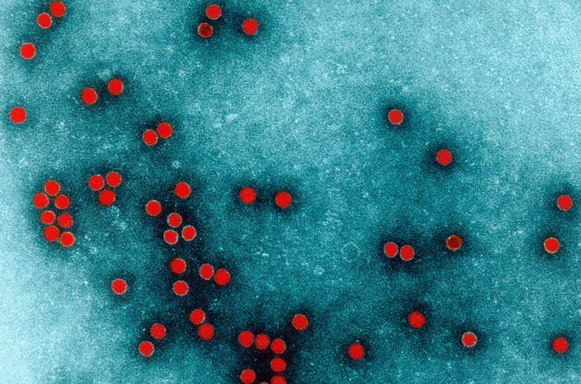 Photo de microscopie colorisée - Virus de la poliomyélite