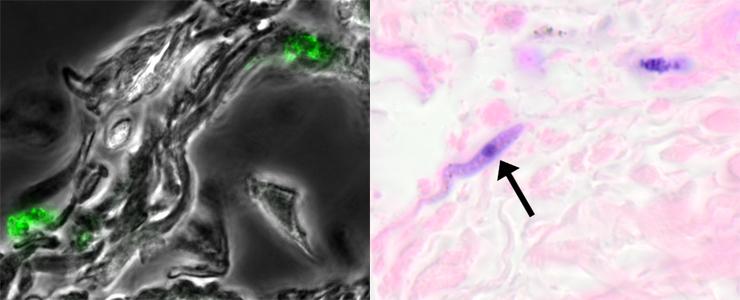 Maladie du sommeil : le parasite se cache dans la peau - Institut Pasteur