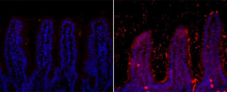 Trop de gras déséquilibre rapidement la flore intestinale - Institut Pasteur