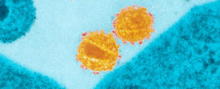 VIH : Identification de récepteurs clés de la réponse immunitaire chez les patients contrôlant spontanément l'infection - Institut Pasteur