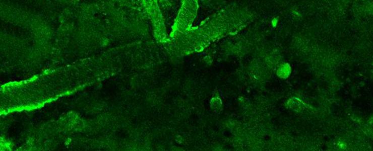 Plaques amyloides marquées par l'anticorps VHH - Institut Pasteur