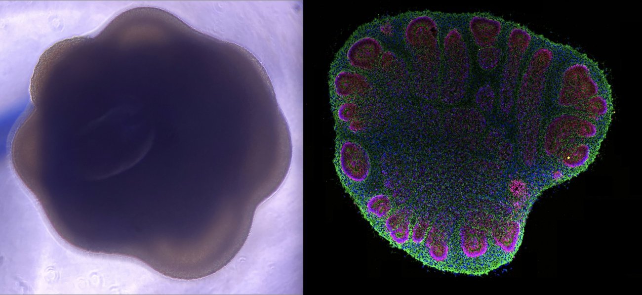 CNES Supbiotech Pasteur Organoid Cerebral Ageing