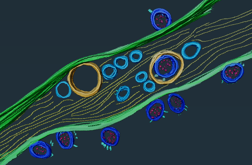Le SARS-CoV-2 détourne les nanotubes reliant les neurones afin de les infecter