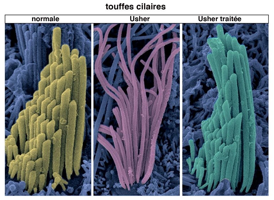 Syndrome de Usher : restauration de l’audition et de l’équilibre grâce à la thérapie génique - Institut Pasteur