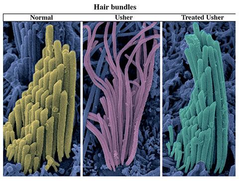 Usher syndrome: gene therapy restores hearing and balance - Institut Pasteur