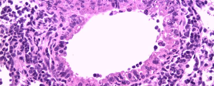 Les calpaïnes, enzymes cellulaires clés pour la lutte anti-grippale - Institut Pasteur Les calpaïnes, enzymes cellulaires clés pour la lutte anti-grippale - Institut Pasteur