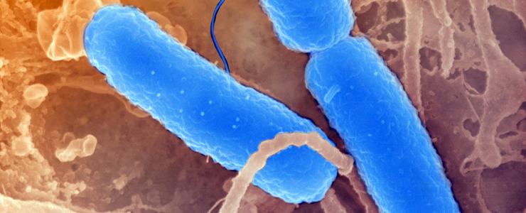 Dysenterie épidémique : enquête génomique sur l’exportation d’un fléau européen - Institut Pasteur