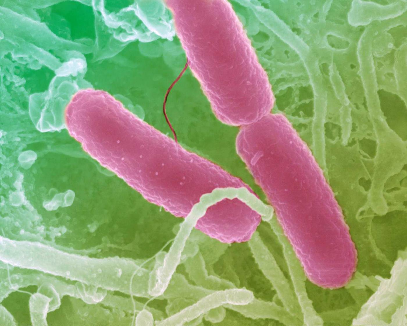 Shigella dysenteriae