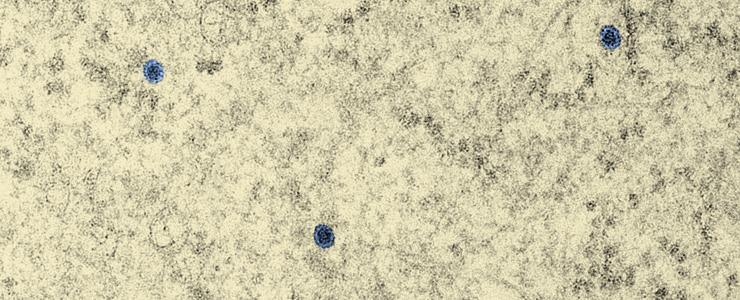 Cellules infectées par le virus Zika - Institut Pasteur Cellules infectées par le virus Zika - Institut Pasteur